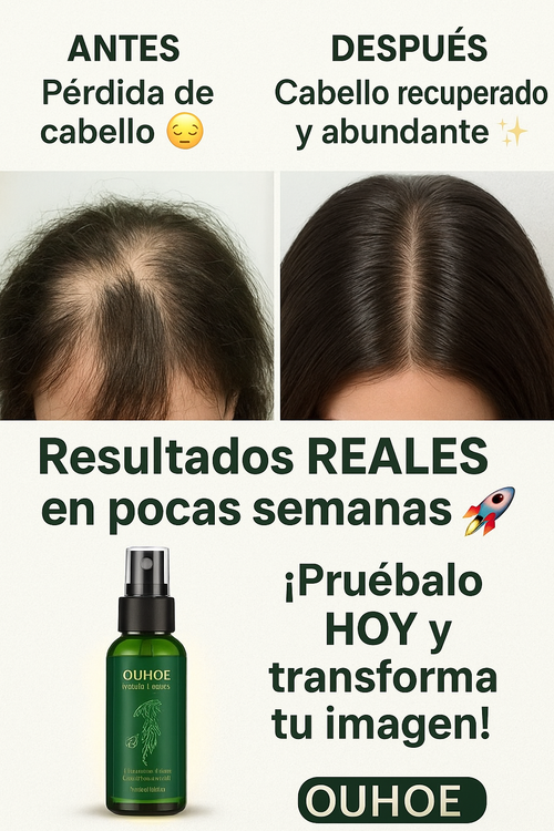 “¿CABELLO MÁS FUERTE EN TIEMPO RÉCORD? ¡Mira este cambio con OUHOE!”
