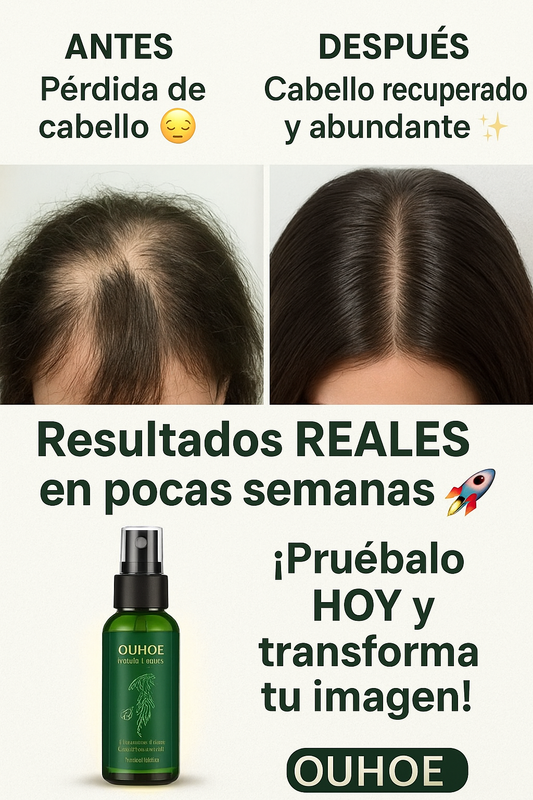 “¿CABELLO MÁS FUERTE EN TIEMPO RÉCORD? ¡Mira este cambio con OUHOE!”