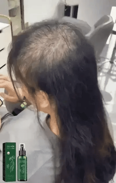“¿CABELLO MÁS FUERTE EN TIEMPO RÉCORD? ¡Mira este cambio con OUHOE!”